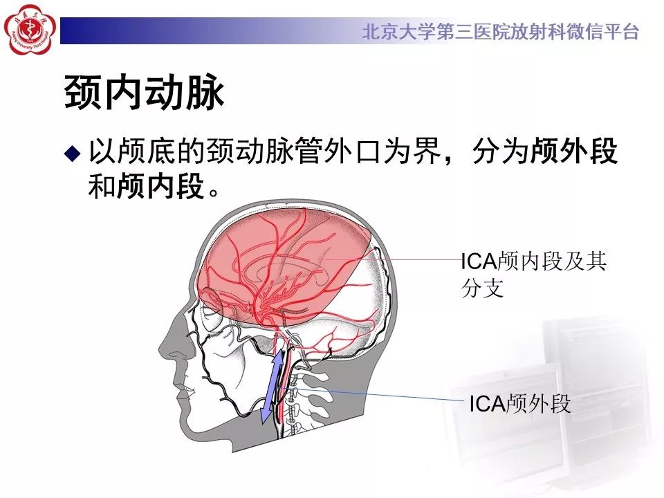 【PPT】脑动脉解剖及供血区分布