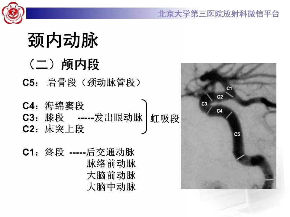 【PPT】脑动脉解剖及供血区分布
