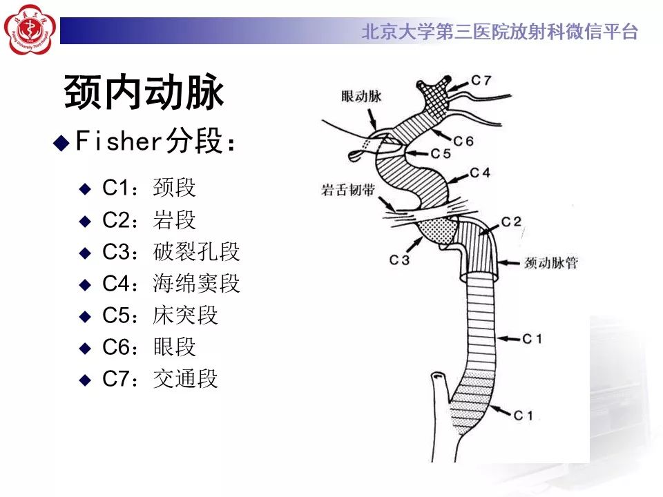 【PPT】脑动脉解剖及供血区分布