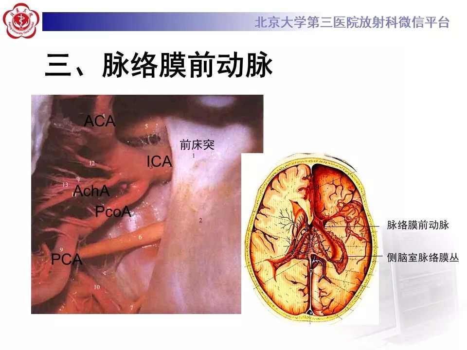 【PPT】脑动脉解剖及供血区分布