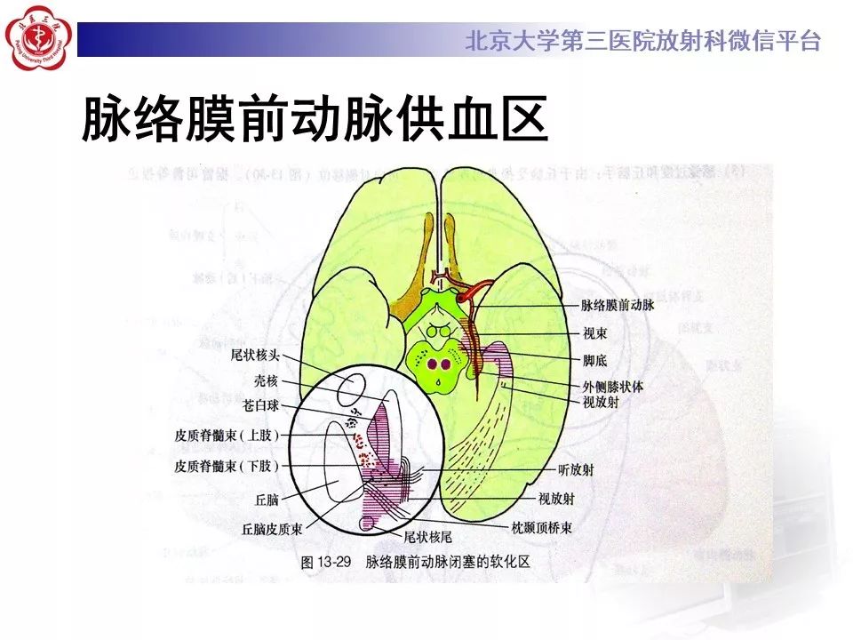【PPT】脑动脉解剖及供血区分布