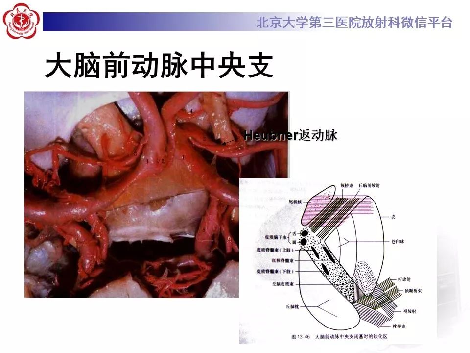 【PPT】脑动脉解剖及供血区分布