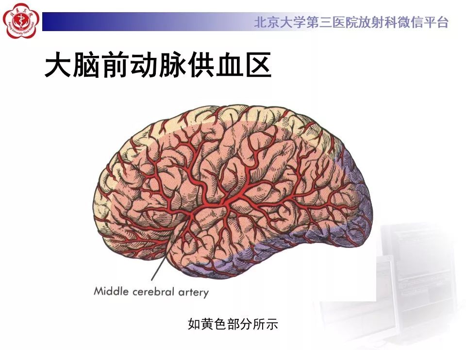 【PPT】脑动脉解剖及供血区分布