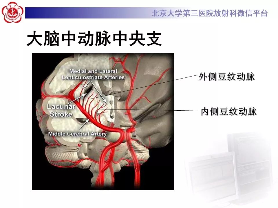【PPT】脑动脉解剖及供血区分布