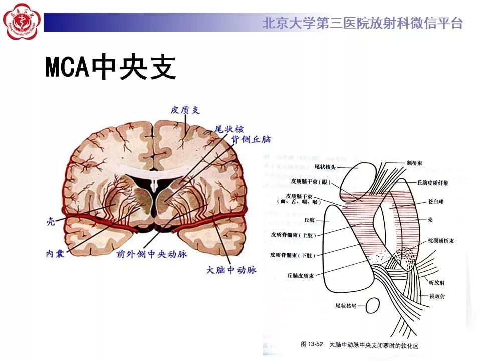 【PPT】脑动脉解剖及供血区分布