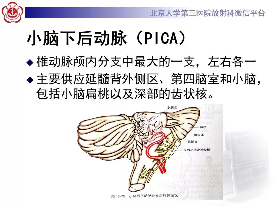 【PPT】脑动脉解剖及供血区分布