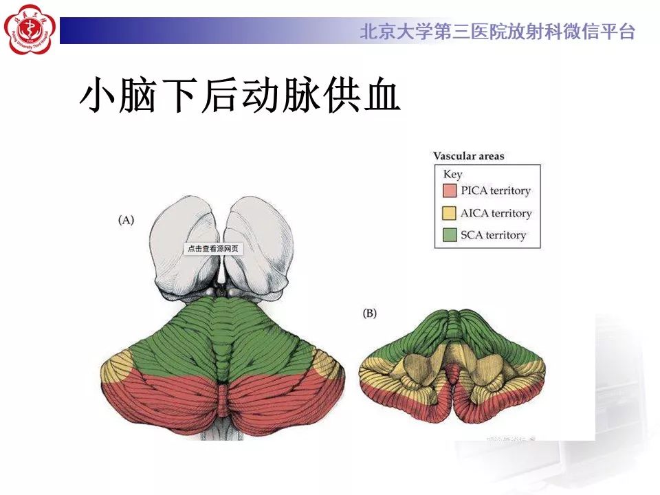 【PPT】脑动脉解剖及供血区分布