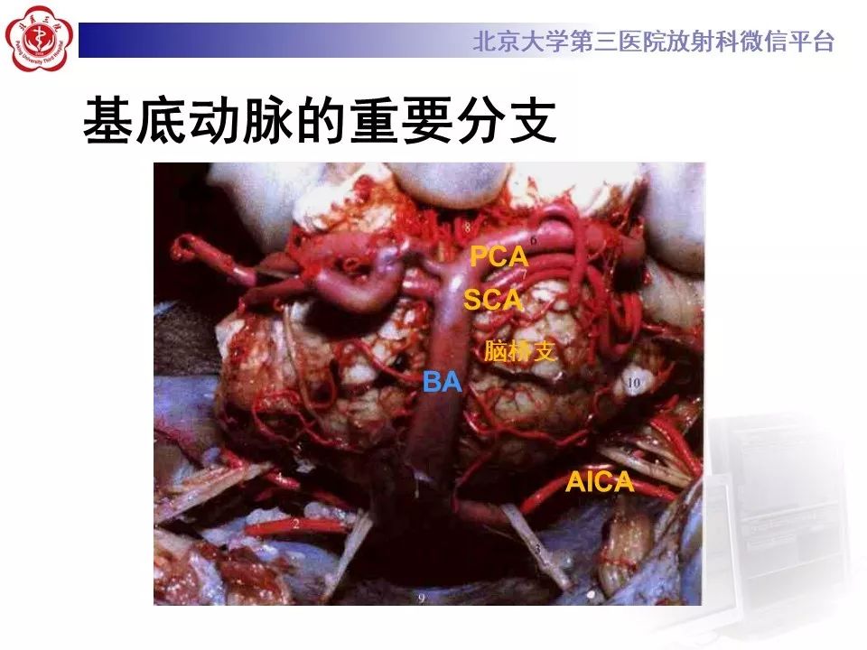 【PPT】脑动脉解剖及供血区分布