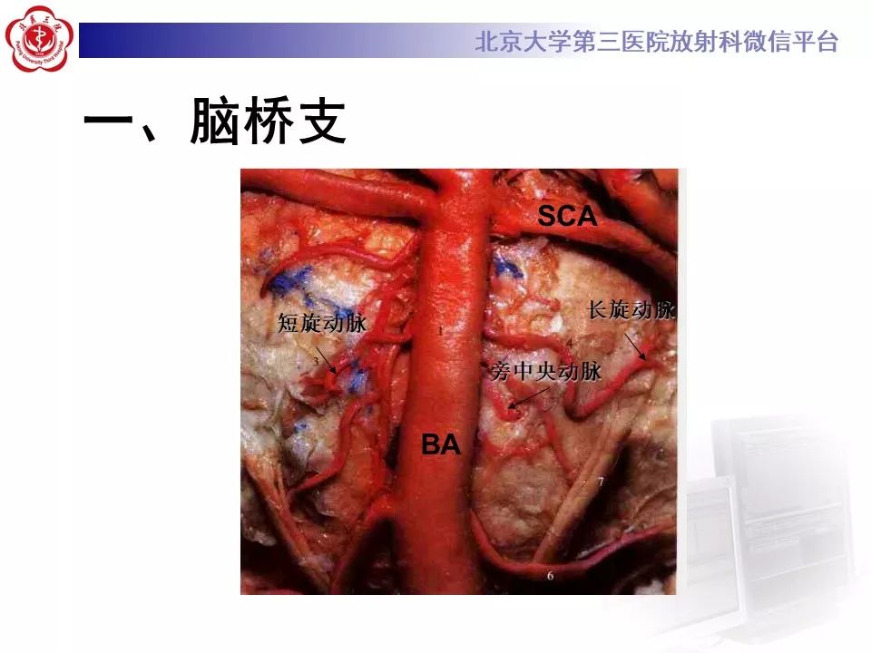 【PPT】脑动脉解剖及供血区分布