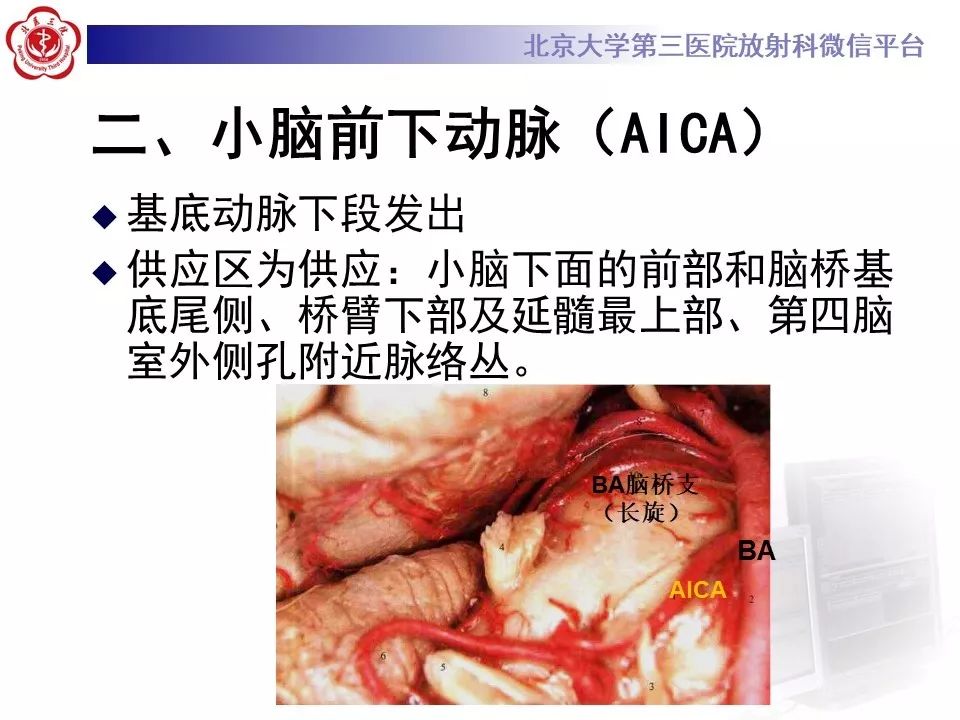 【PPT】脑动脉解剖及供血区分布
