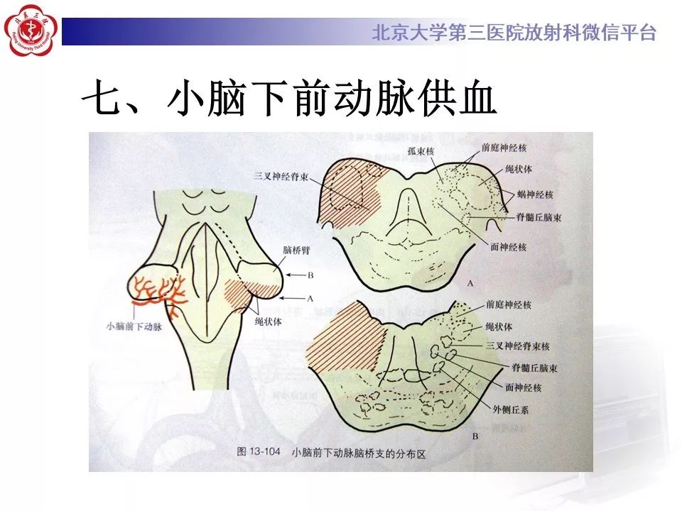 【PPT】脑动脉解剖及供血区分布