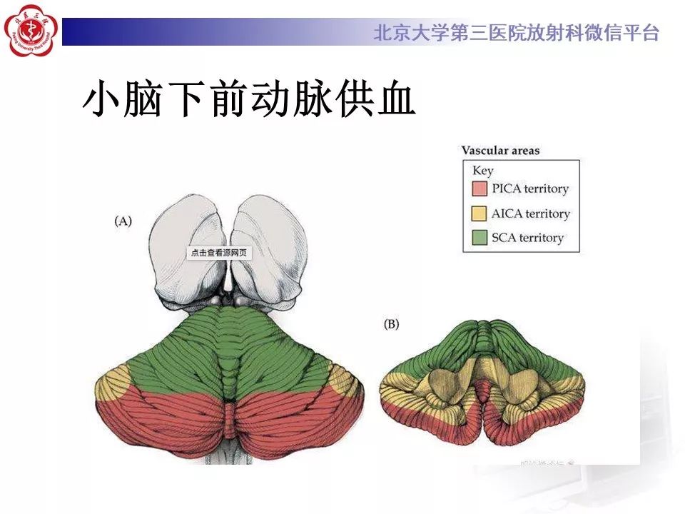 【PPT】脑动脉解剖及供血区分布
