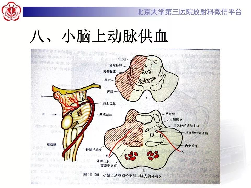 【PPT】脑动脉解剖及供血区分布