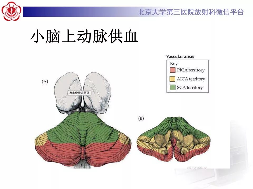 【PPT】脑动脉解剖及供血区分布