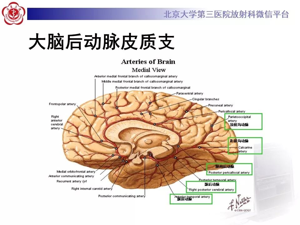 【PPT】脑动脉解剖及供血区分布