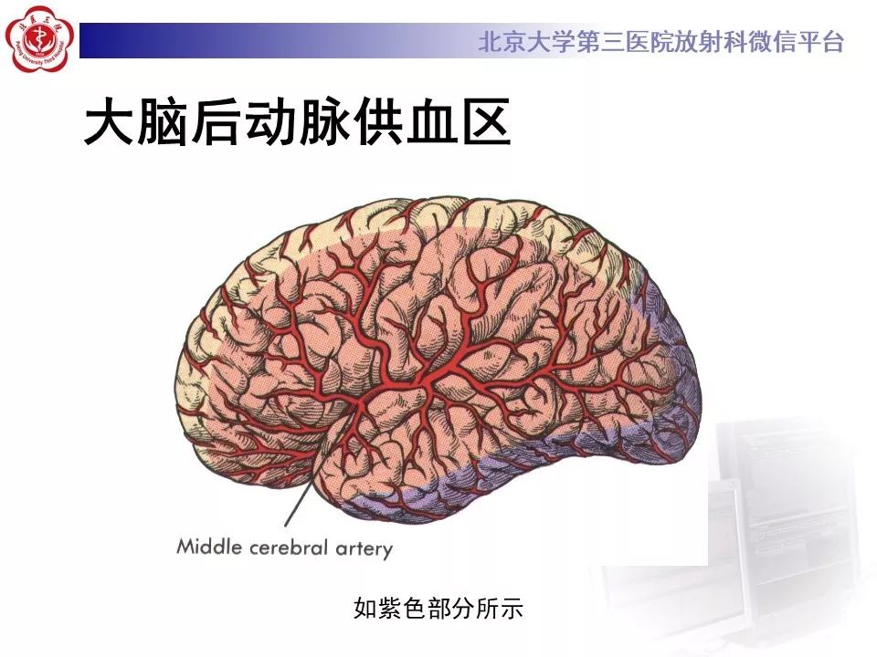 【PPT】脑动脉解剖及供血区分布