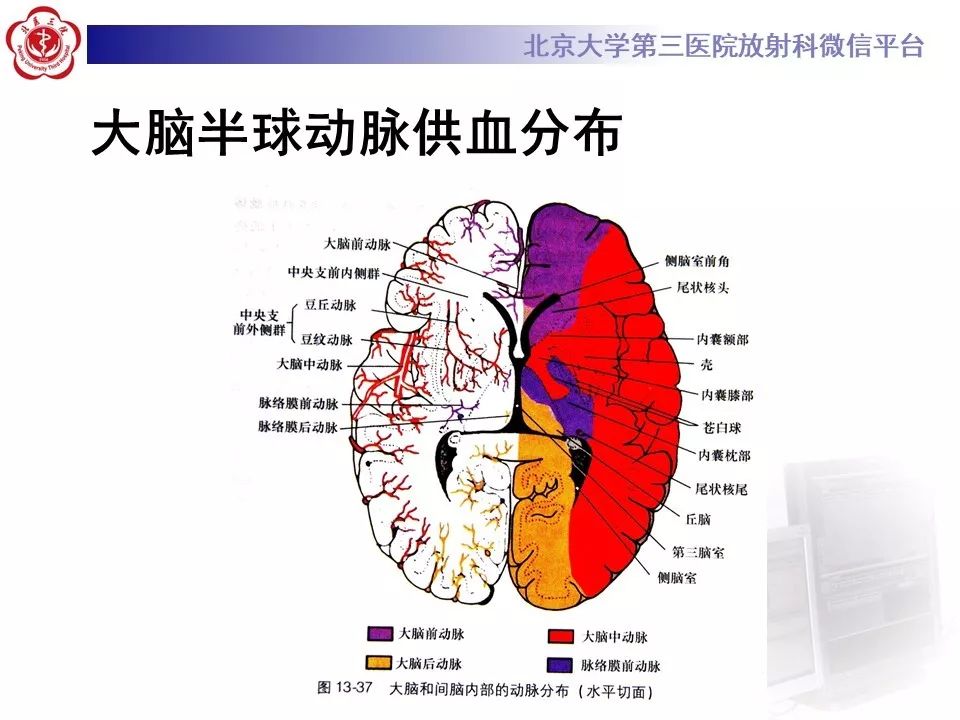 【PPT】脑动脉解剖及供血区分布