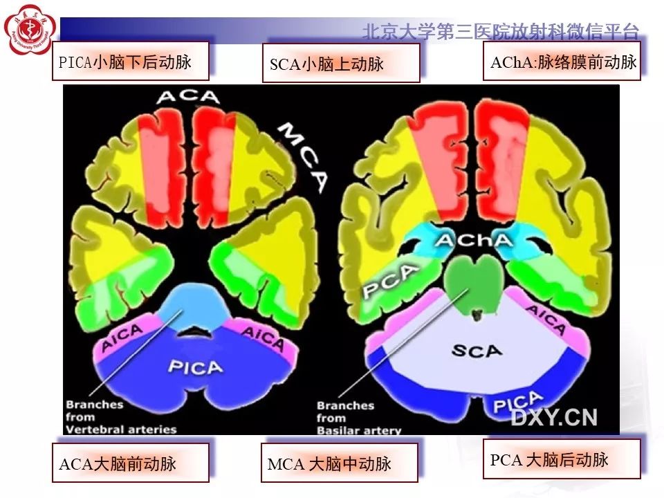 【PPT】脑动脉解剖及供血区分布
