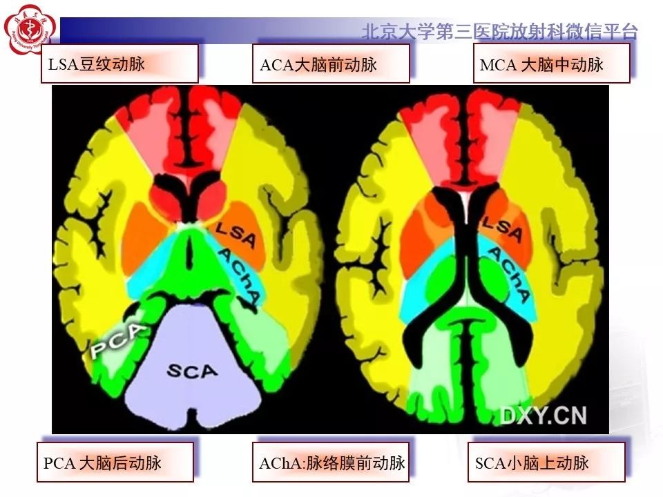 【PPT】脑动脉解剖及供血区分布