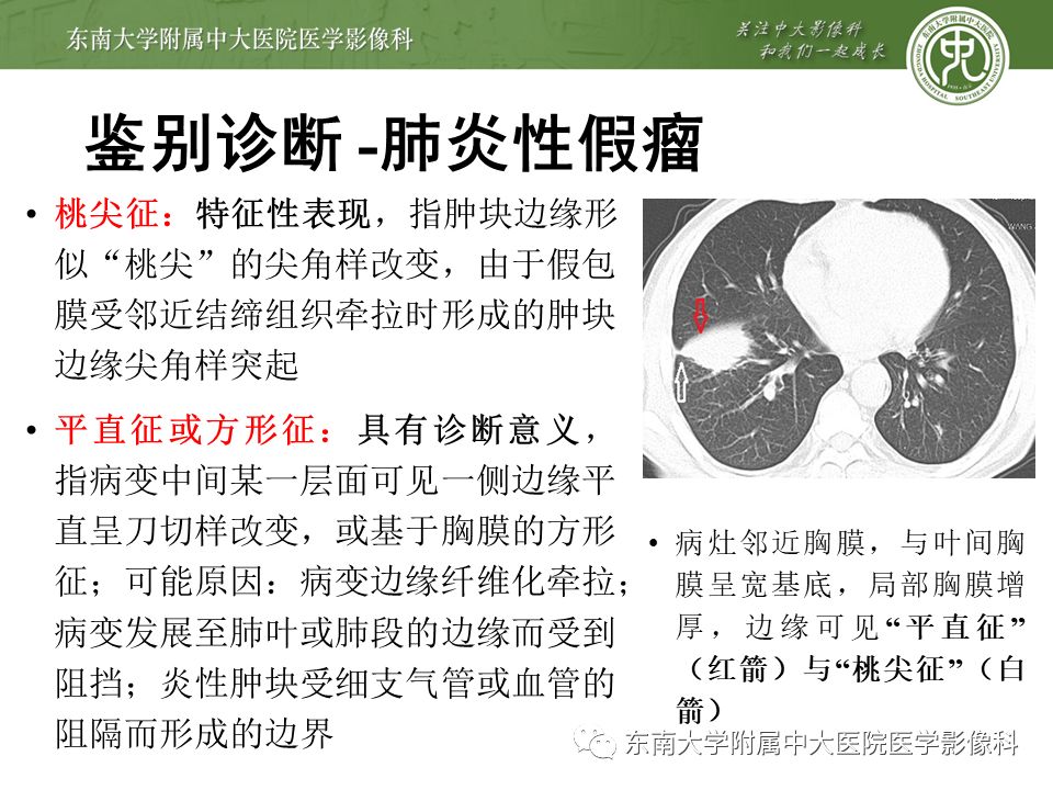 【PPT】局灶性机化性肺炎