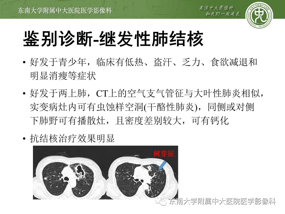 【PPT】局灶性机化性肺炎
