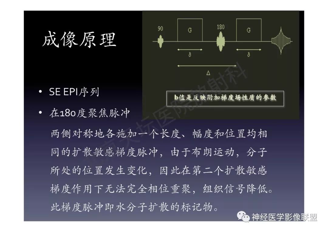 【PPT】颅内DWI高信号的MRI诊断