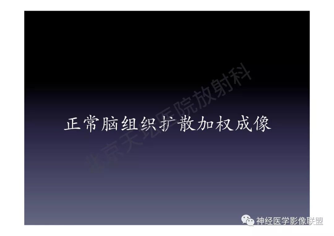 【PPT】颅内DWI高信号的MRI诊断