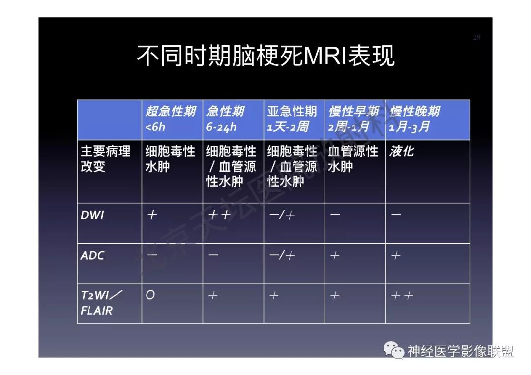 【PPT】颅内DWI高信号的MRI诊断