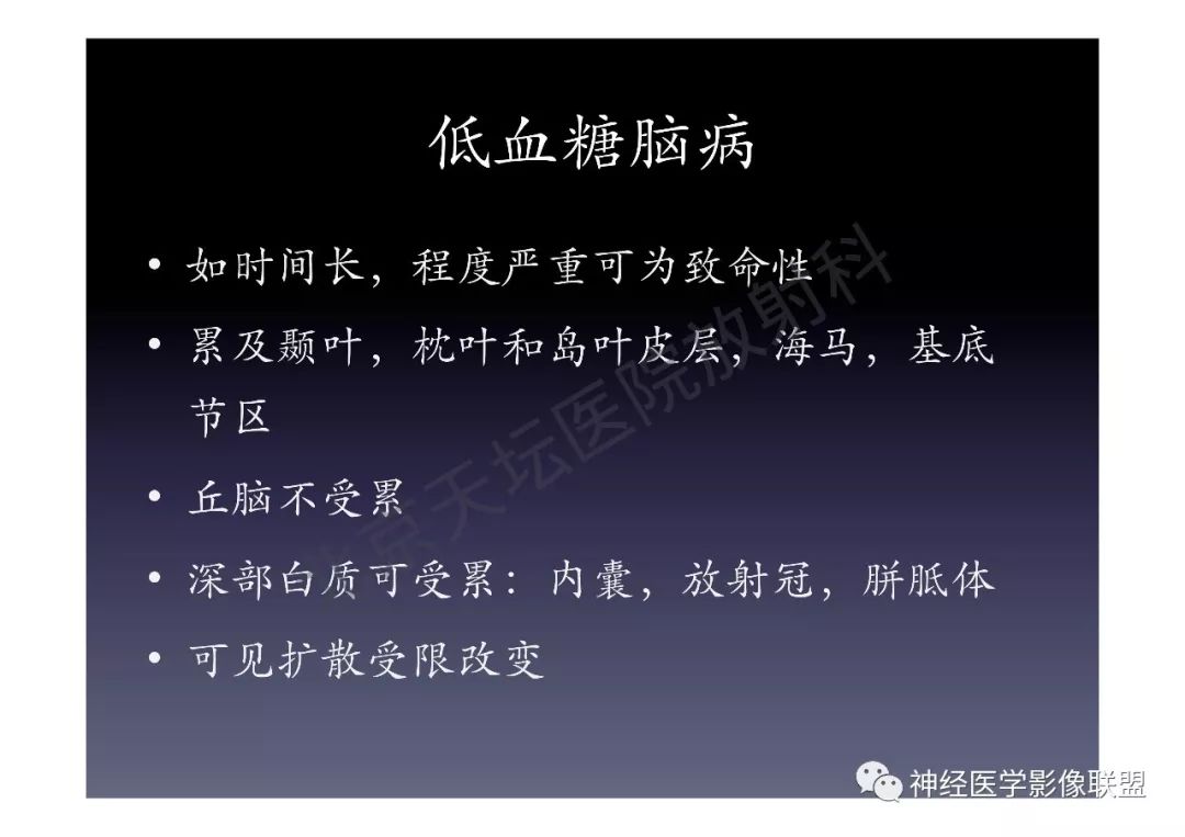 【PPT】颅内DWI高信号的MRI诊断