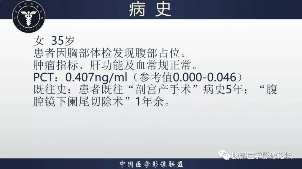 【病例】十二指肠水平部肠系膜纤维瘤病1例CT及MR