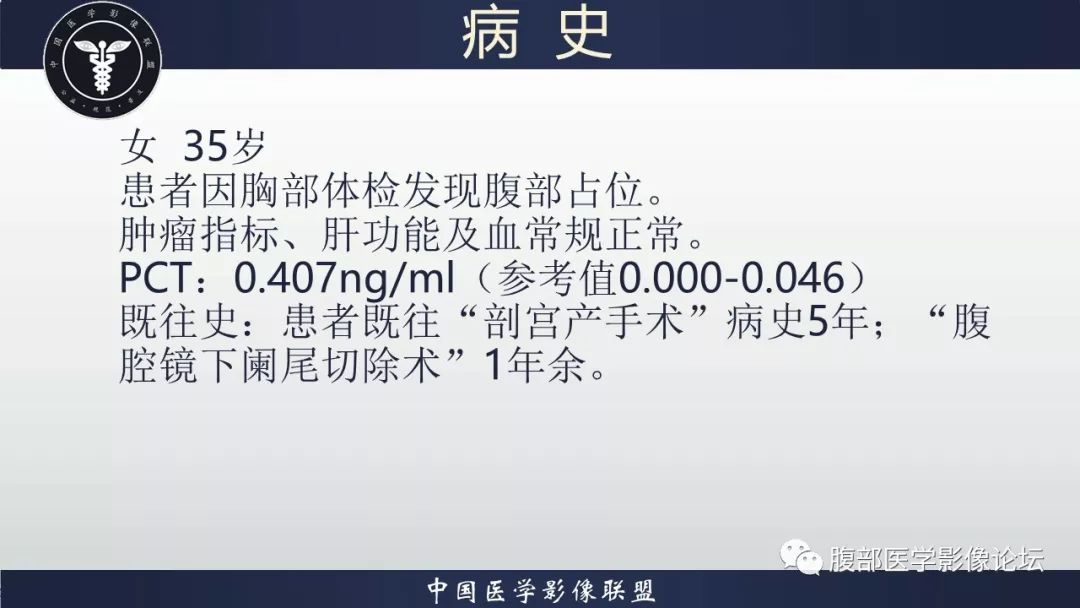 【病例】十二指肠水平部肠系膜纤维瘤病1例CT及MR