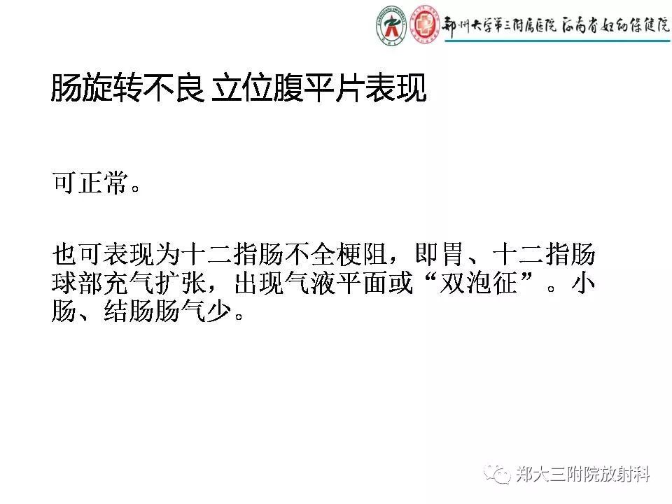 【PPT】肠系膜上动脉综合征​