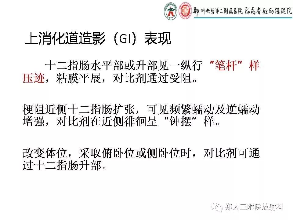【PPT】肠系膜上动脉综合征​