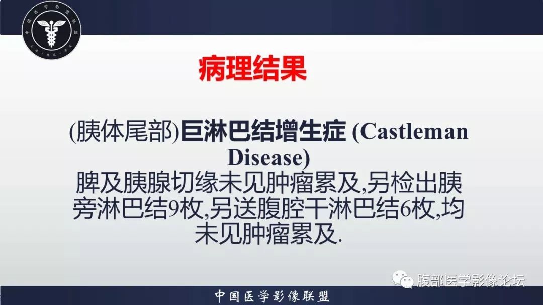 【病例】胰体尾部巨淋巴结增生症1例