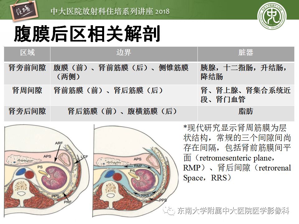 【PPT】腹膜后外伤的CT表现