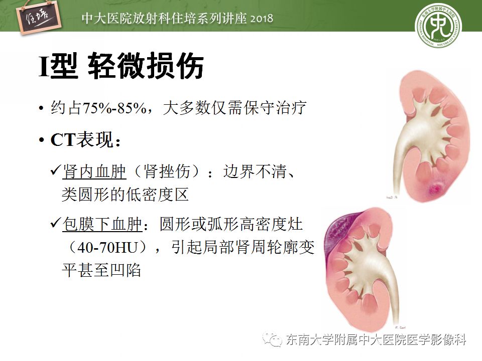 【PPT】腹膜后外伤的CT表现