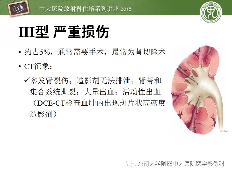 【PPT】腹膜后外伤的CT表现
