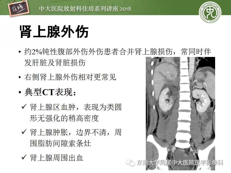 【PPT】腹膜后外伤的CT表现