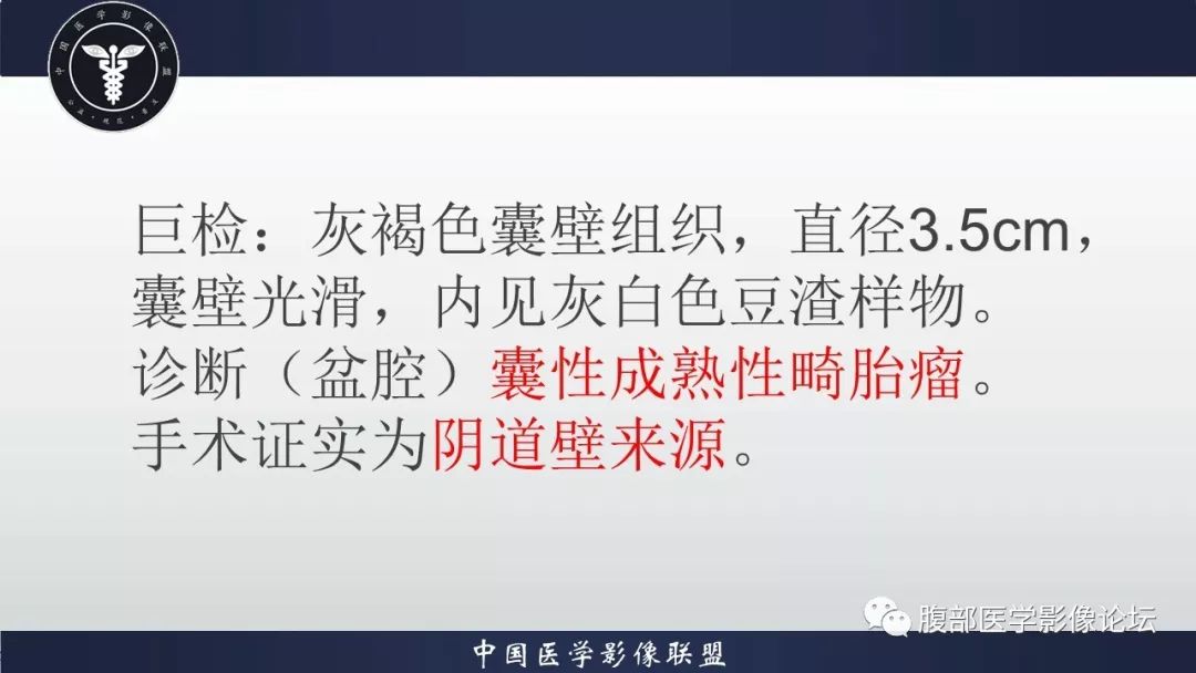 【病例】阴道壁囊性成熟性畸胎瘤1例MR影像