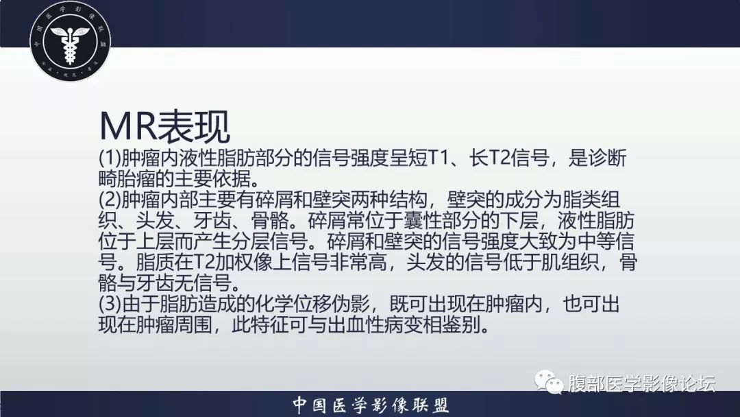 【病例】阴道壁囊性成熟性畸胎瘤1例MR影像