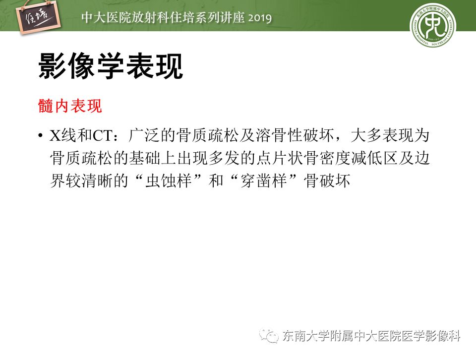 【PPT】常见恶性骨肿瘤的影像诊断