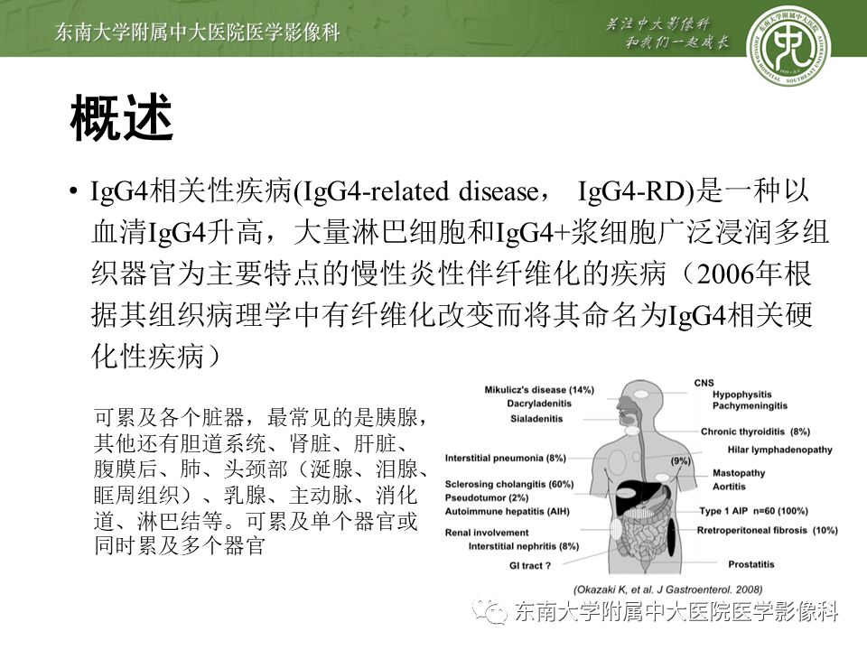 【PPT】IgG4相关性胰腺炎影像诊断