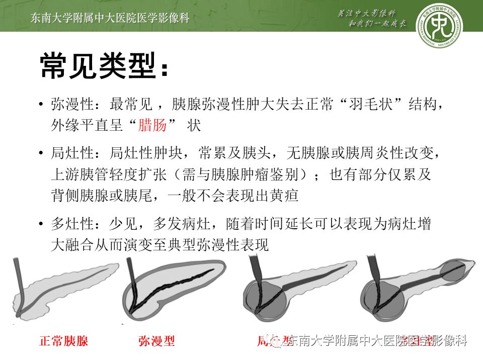 【PPT】IgG4相关性胰腺炎影像诊断
