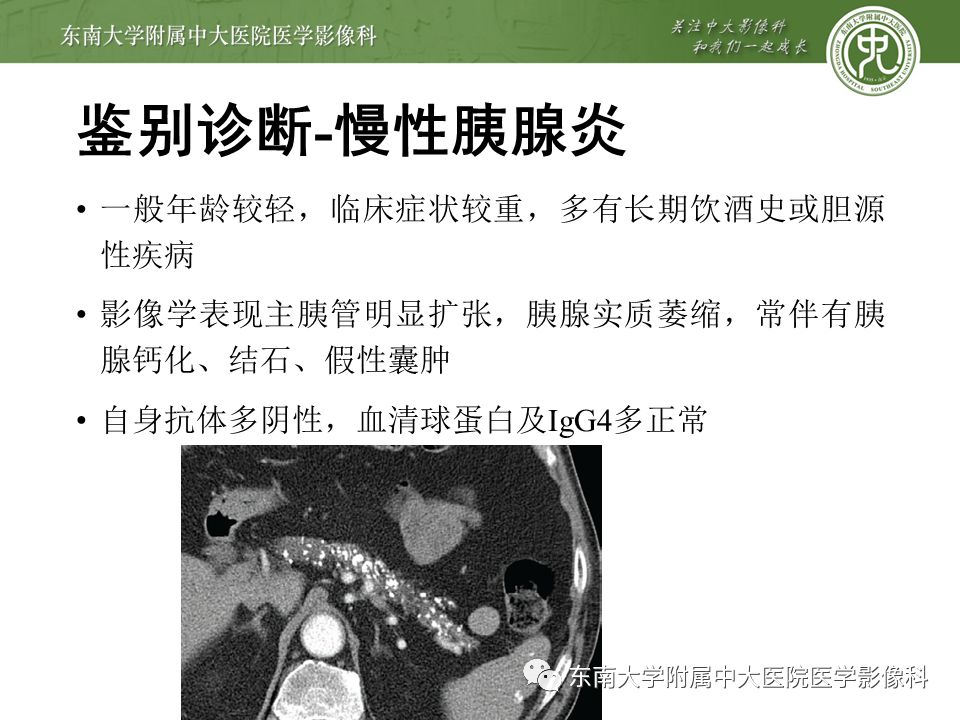 【PPT】IgG4相关性胰腺炎影像诊断