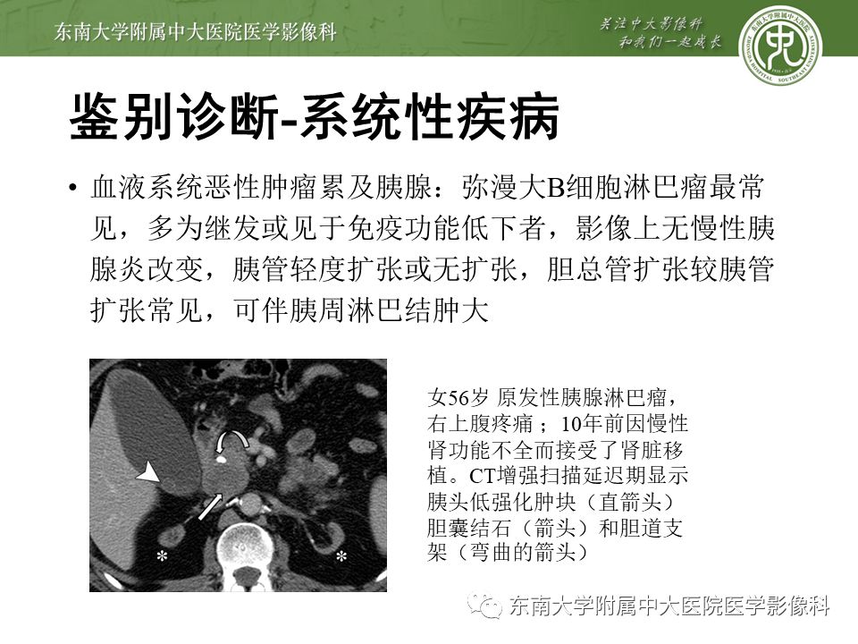 【PPT】IgG4相关性胰腺炎影像诊断