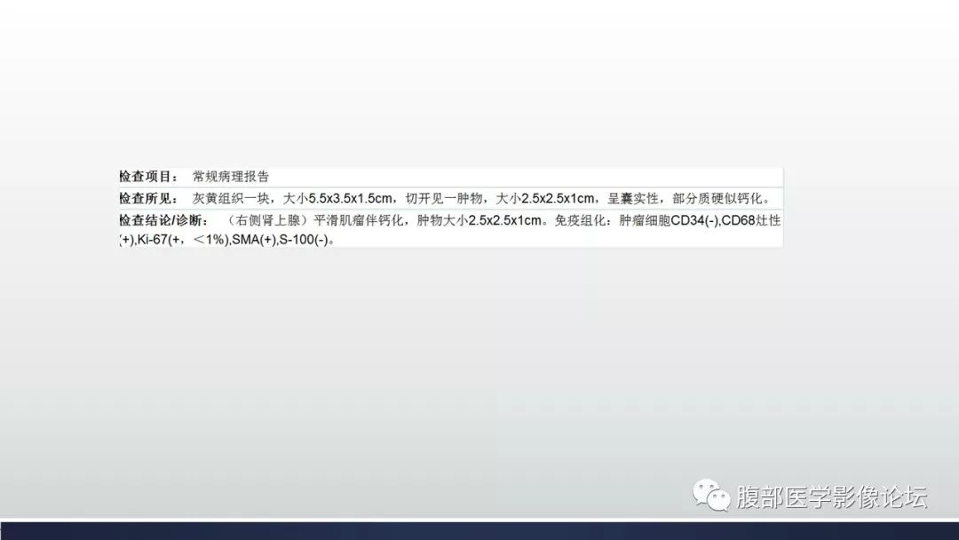 【病例】肾上腺平滑肌瘤1例CT影像鉴别诊断