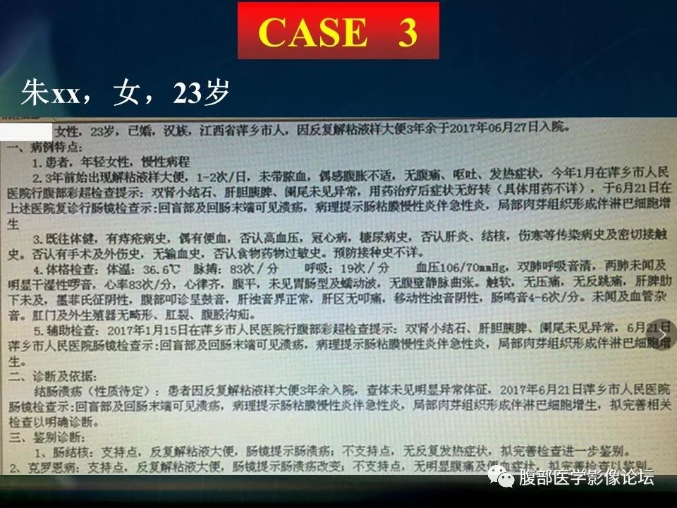 【PPT】小肠疾病读片—克罗恩病、肠结核、溃疡性结肠炎鉴别诊断