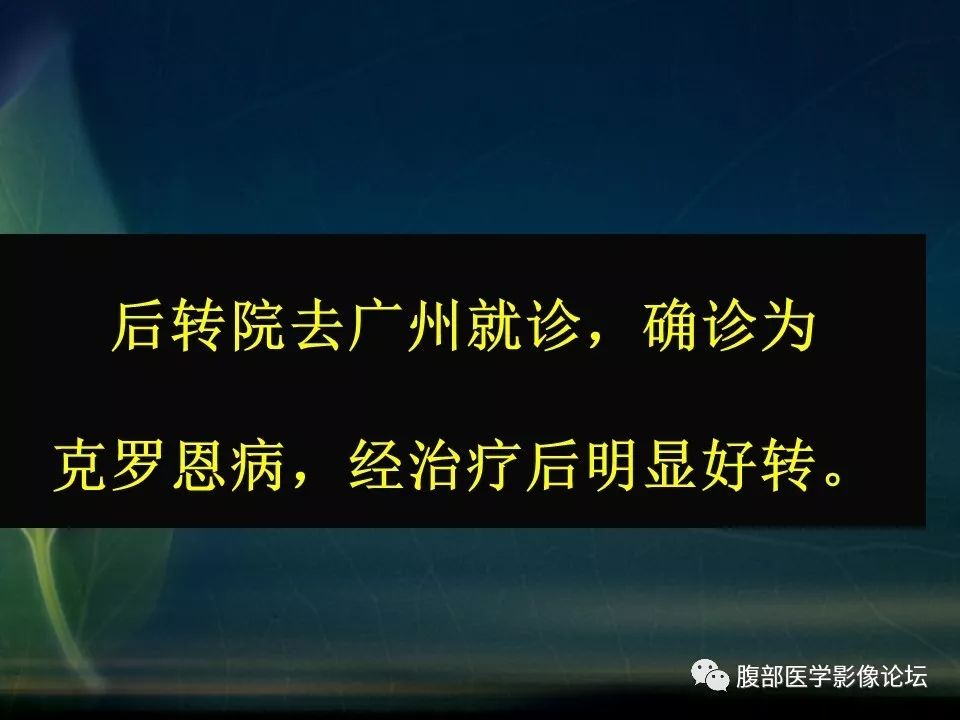 【PPT】小肠疾病读片—克罗恩病、肠结核、溃疡性结肠炎鉴别诊断