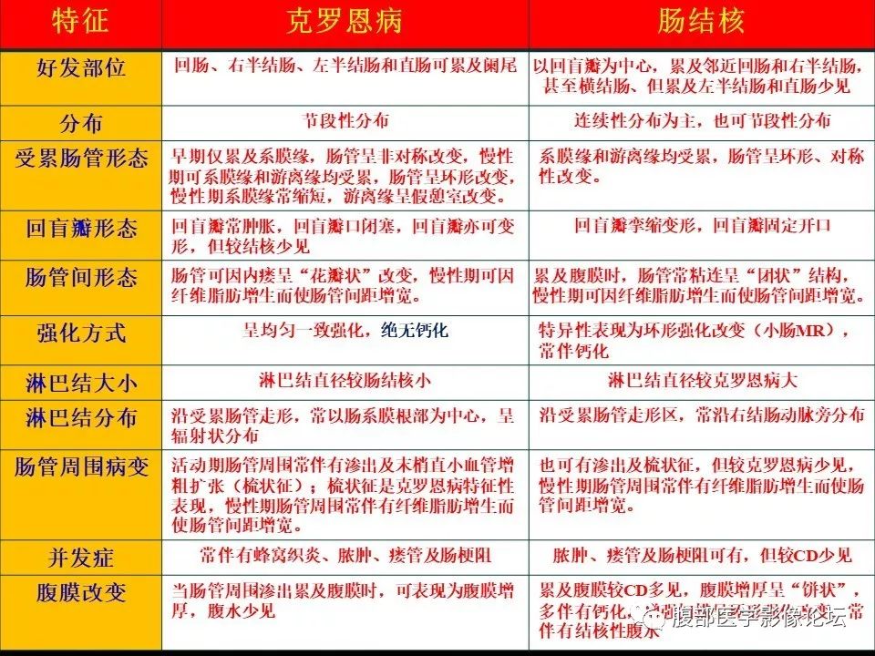 【PPT】小肠疾病读片—克罗恩病、肠结核、溃疡性结肠炎鉴别诊断