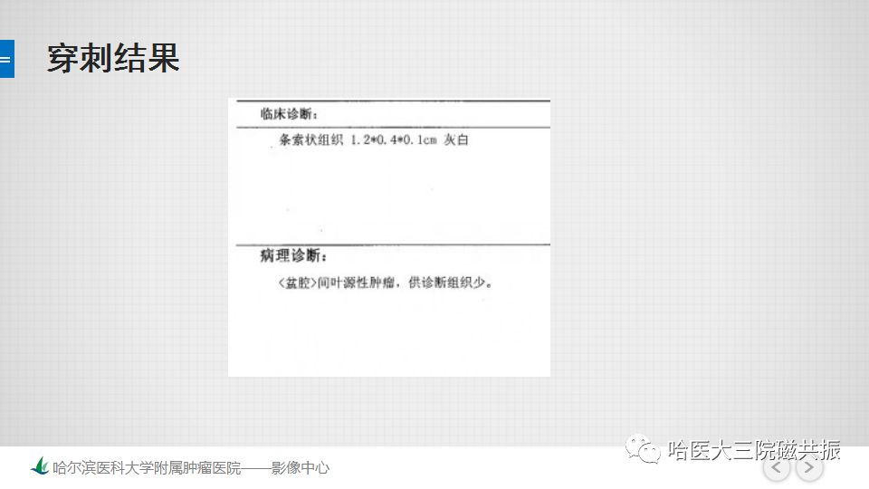 【PPT】胃肠道间质瘤—直肠病例讨论